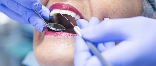 Best Emergency Broken Tooth Repair in New Berlin, IL